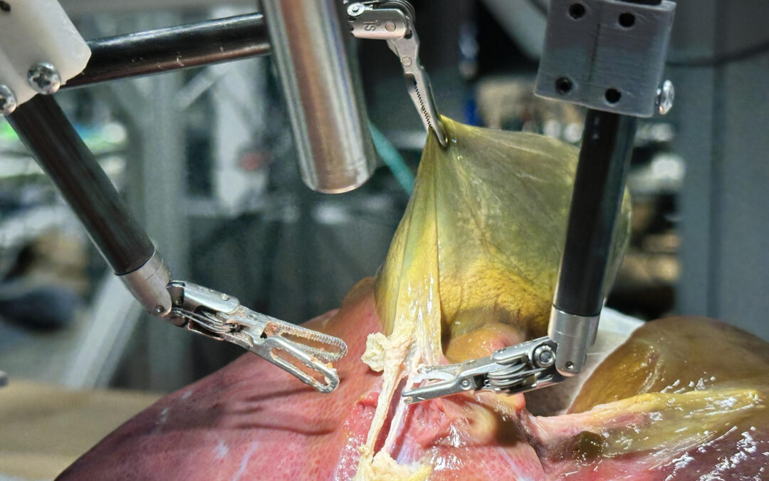 Un robot con inteligencia artificial realiza por primera vez una cirugía realista sin ayuda humana